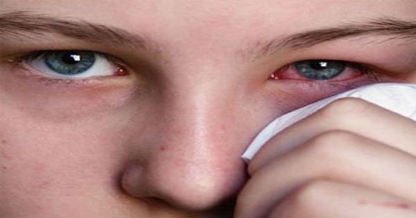 Chữa đau mắt và phục hồi sau mổ mắt